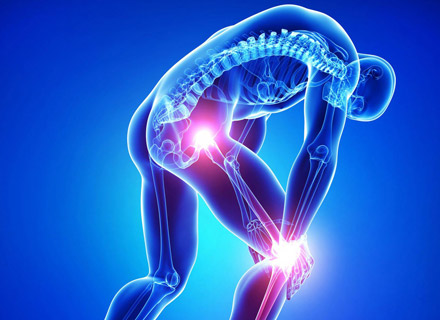 arthrographie